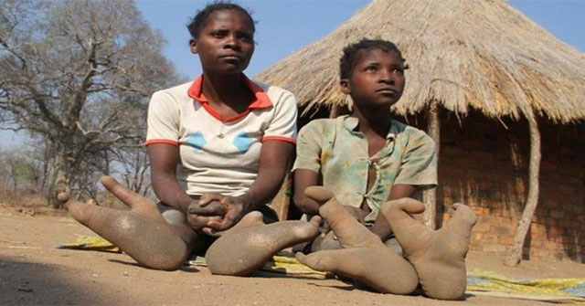 Khám Phá Bộ Lạc Vadoma: Những Con Người Đà Điểu Bí Ẩn Ở Châu Phi