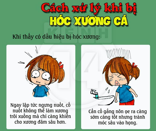 Giải quyết tình huống hóc xương cá hiệu quả