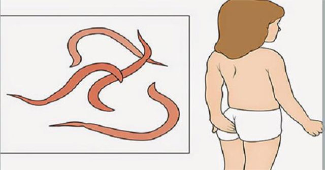 Giun kim ở trẻ em: cách nhận biết và xử trí an toàn tại nhà